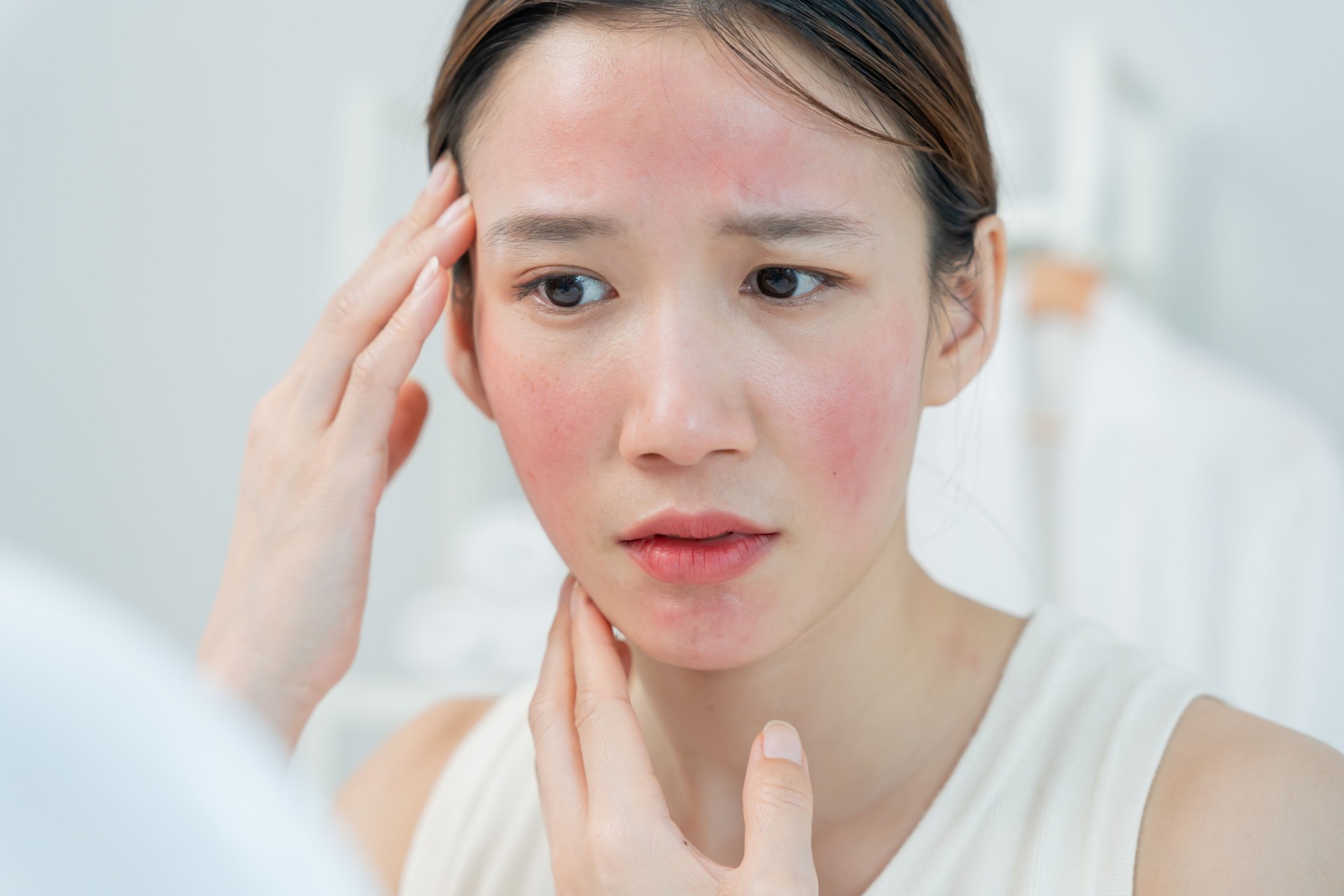 Woman worried about face Dermatology, rosacea dermatitis, allergic steroids, sensitive skin, red face from sunburn, acne, dry skin, large pores ,rash face, dull, freckles, wrinkle, skin problem